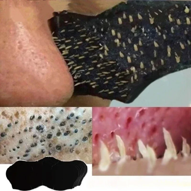 Unisex Blackhead Remove Mask N - مراجعة Skincare Viral Tiktok وسعره